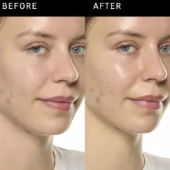 Ectoin Hydro-Barrier Serum - Återfuktande och skyddande serum
