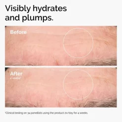 Hyaluronic Acid 2% + B5