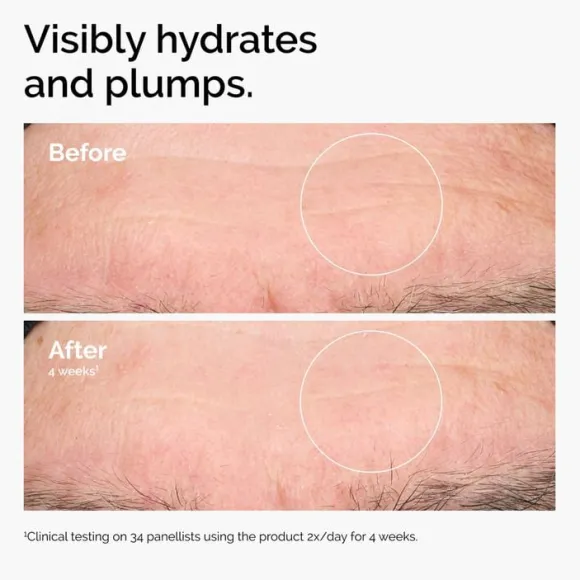 Hyaluronic Acid 2% + B5