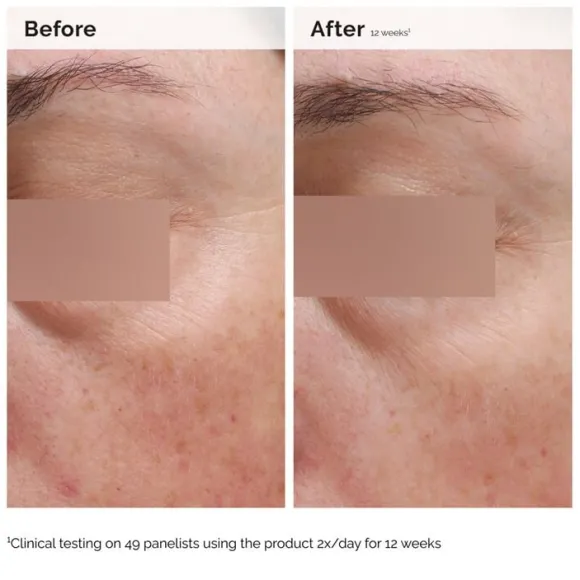 Niacinamide 5% Face and Body Emulsion