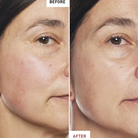 Skin Therapy - Multi-Perfecting Night Oil