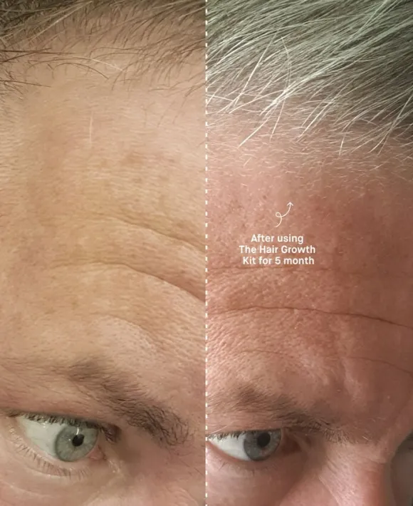 The Hair Growth Kit
